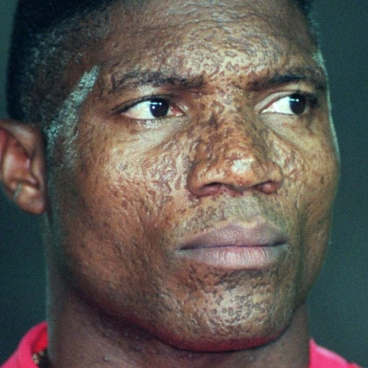 Nigéria - Peter Rufai : Décès Du Légendaire Gardien Du Nigeria Et Héros De La Can 1994